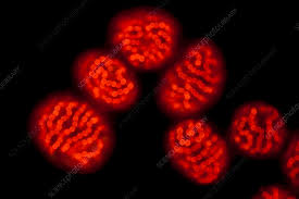 Attēlu rezultāti vaicājumam “Nostoc pruniforme”