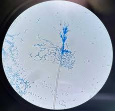 Attēlu rezultāti vaicājumam “Badhamia lilacina spores”