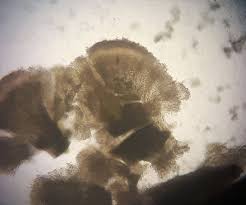 Attēlu rezultāti vaicājumam “Didymium serpula spores”