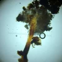 Attēlu rezultāti vaicājumam “Chaenotheca trichialis”