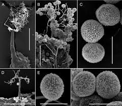 Attēlu rezultāti vaicājumam “Didymium annulisporum spores”