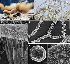 Attēlu rezultāti vaicājumam “Arcyria incarnata spores”
