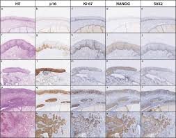 Image result for  N   E       O X j   O