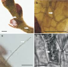 Attēlu rezultāti vaicājumam “Cephaloziella elachista”