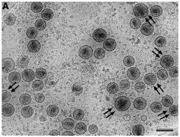 Image result for фотография вируса вич