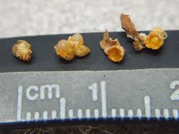 Attēlu rezultāti vaicājumam “Sphaerobolus stellatus”