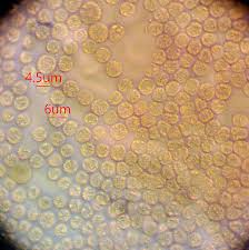 Attēlu rezultāti vaicājumam “Lycogala persicum macro”