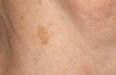 Great Skin After5 0.