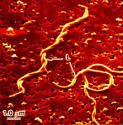 <b>Borrelia burgdorferi</b>