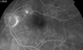 Attēlu rezultāti vaicājumam “Reticularia jurana macro”