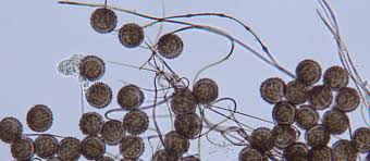 Attēlu rezultāti vaicājumam “Colloderma oculatum spores”