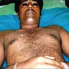 Image result for Lewandowsky-Lutz