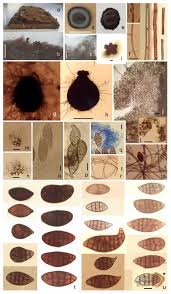 Attēlu rezultāti vaicājumam “Badhamiopsis ainoae spores”