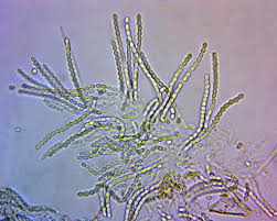 Attēlu rezultāti vaicājumam “Hypocrea pulvinata”