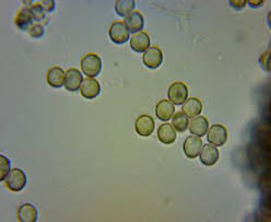 Attēlu rezultāti vaicājumam “Stemonitopsis typhina spores”