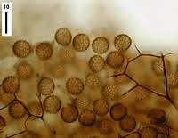 Attēlu rezultāti vaicājumam “Stemonitis fusca spores”