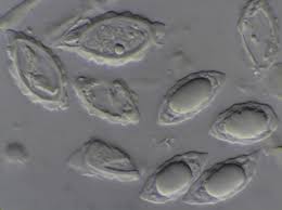 Attēlu rezultāti vaicājumam “Cribraria rubiginosa spores”