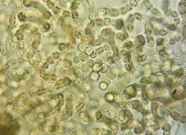 Attēlu rezultāti vaicājumam “Nostoc pruniforme macro”