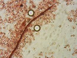 Attēlu rezultāti vaicājumam “Cribraria cancellata stalked”