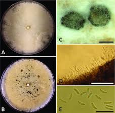 Attēlu rezultāti vaicājumam “Ophiotheca chrysosperma spores”