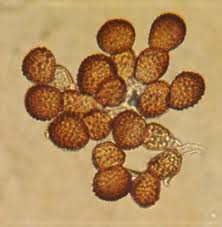 Attēlu rezultāti vaicājumam “Tranzschelia pruni-spinosae spores”