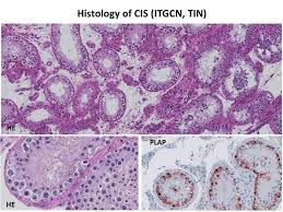 Image result for %E1%83%99%E1...tart=40