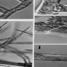 Attēlu rezultāti vaicājumam “Homomallium incurvatum sporophyte”