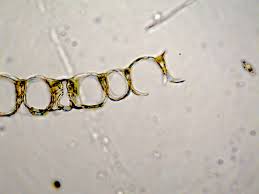 Attēlu rezultāti vaicājumam “Sphagnum palustre sporophyte”