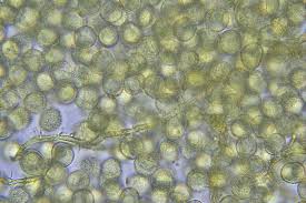 Attēlu rezultāti vaicājumam “Hemitrichia chrysospora sessile”