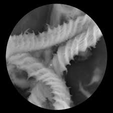 Attēlu rezultāti vaicājumam “Oligonema affine spores”