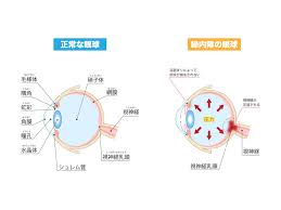 「烏頭みこと」の画像検索結果