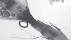 Attēlu rezultāti vaicājumam “Orthotrichum patens”