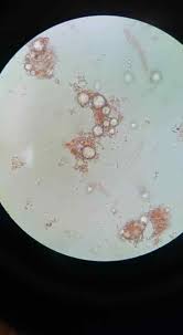 Attēlu rezultāti vaicājumam “Lindbladia tubulina spores”