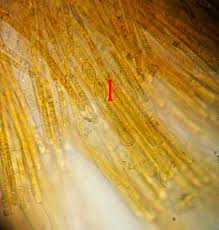 Attēlu rezultāti vaicājumam “Octospora splachnophila”