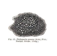 Attēlu rezultāti vaicājumam “Pertusaria amara”