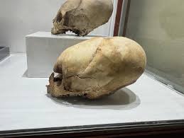 Image result for elongated skulls