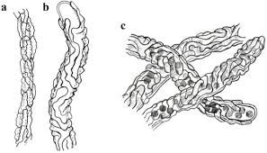 Attēlu rezultāti vaicājumam “Cystocoleus ebeneus”