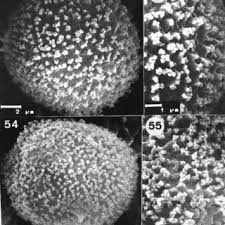 Attēlu rezultāti vaicājumam “Heterotrichia pomiformis (syn. Arcyria pomiformis) spores”
