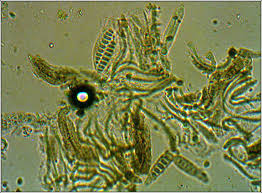 Attēlu rezultāti vaicājumam “Graphis scripta”