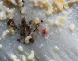 Attēlu rezultāti vaicājumam “Fuligo laevis spores”