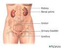 Urinary Tract Infection (UTI) | Urology at UCLA