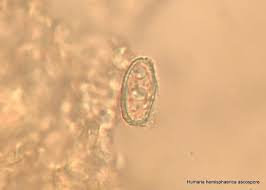Attēlu rezultāti vaicājumam “Humaria hemisphaerica”