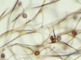 Attēlu rezultāti vaicājumam “Lamproderma pulchellum”