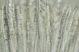 Attēlu rezultāti vaicājumam “Hymenoscyphus imberbis”