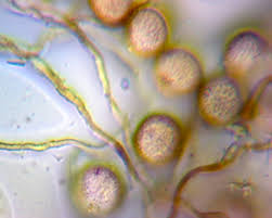 Attēlu rezultāti vaicājumam “Didymium minus spores”