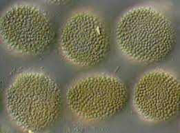 Attēlu rezultāti vaicājumam “Melampsora magnusiana”