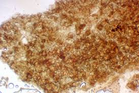 Attēlu rezultāti vaicājumam “Lycogala paraconfusum”