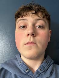 Image result for Austerlands Cc