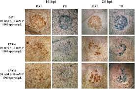 Attēlu rezultāti vaicājumam “Lycogala botrydium spores”