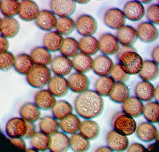Attēlu rezultāti vaicājumam “Licea chelonoides spores”